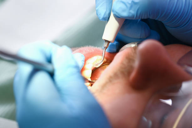 Best Broken or Chipped Tooth Repair in Lower Burrell, PA